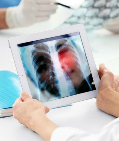 Endobronchial Ultrasound Ankara